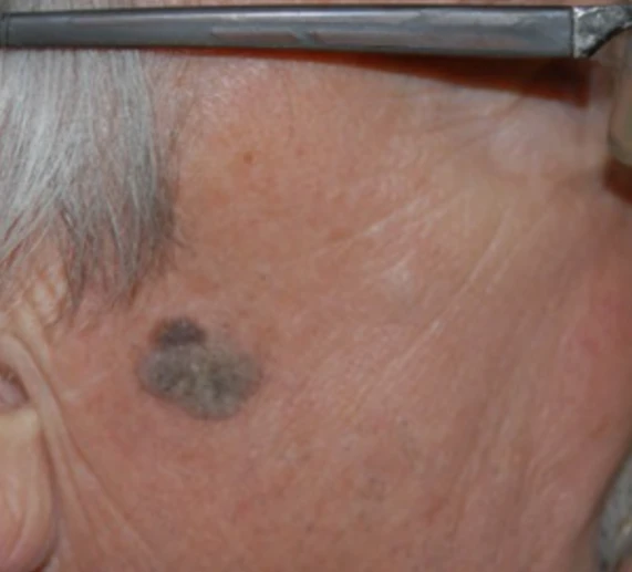 photo - Skin Balance