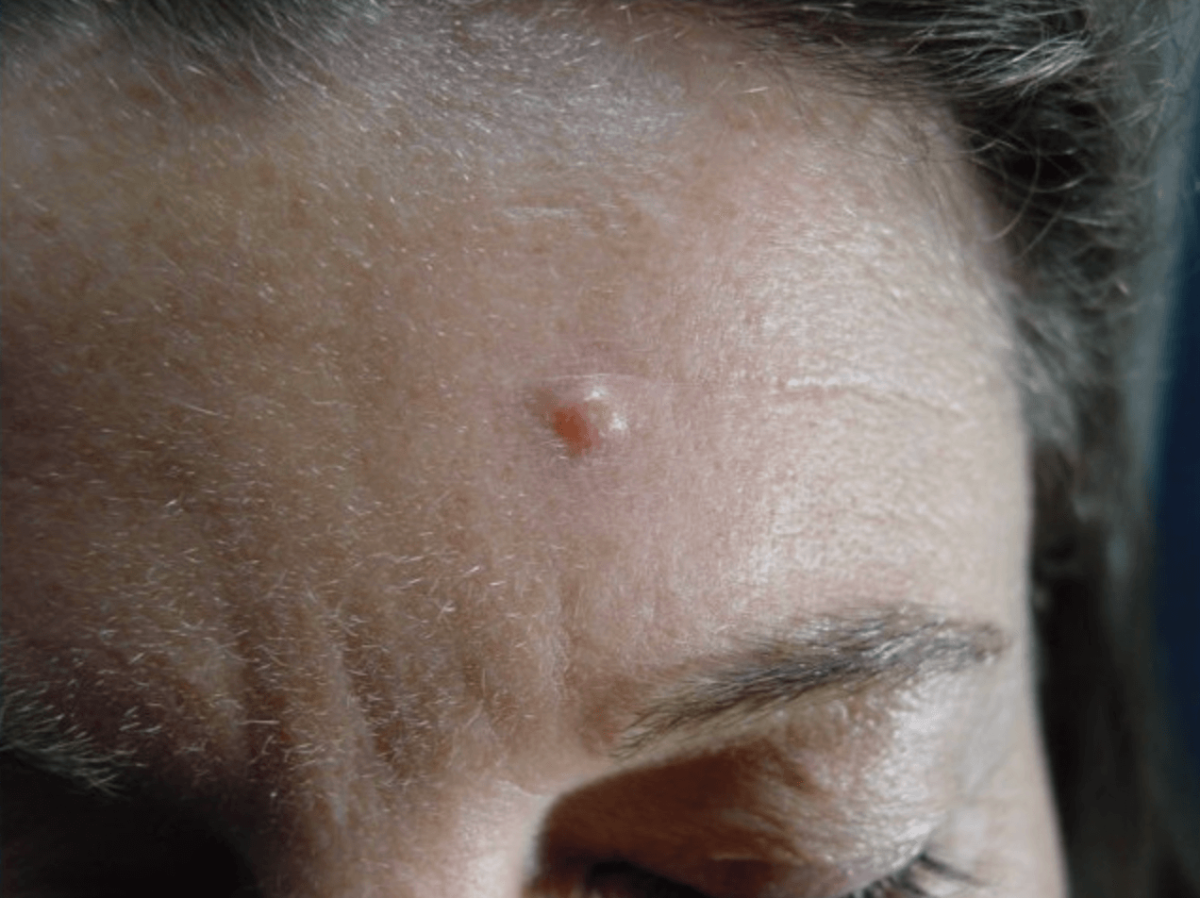 photo - Skin Balance