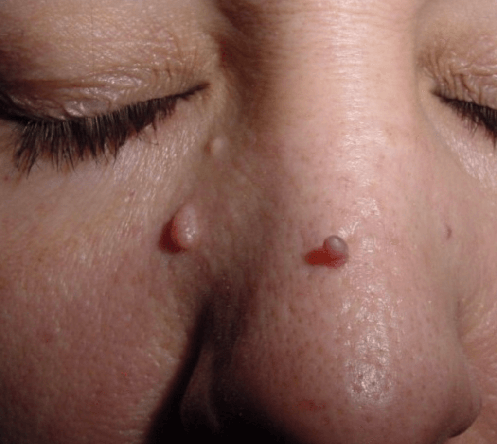 photo - Skin Balance